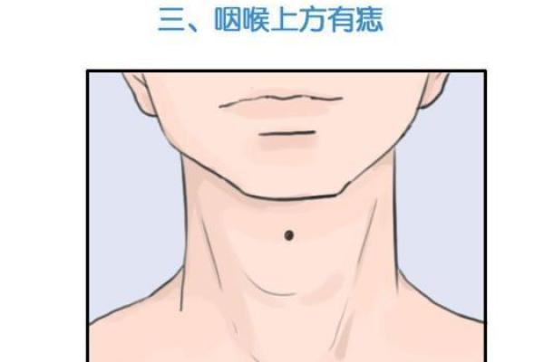 有钱痣相：揭示财富与命运的神秘联系