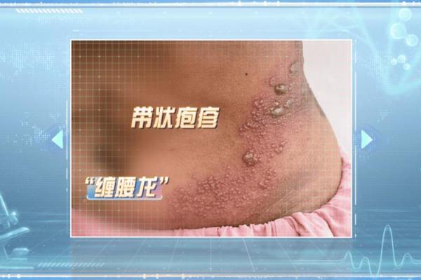 探秘腰左侧痣相的象征意义与性格特征