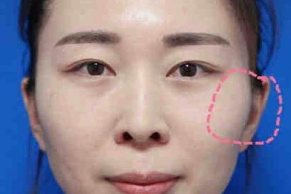 如何从颧骨高的男人面相看出他的事业运势