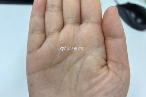 炸腮面相的面相解析与命运影响