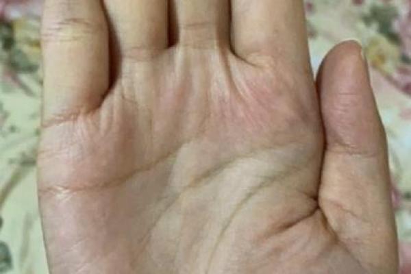 岛纹手相图片与命理深度分析