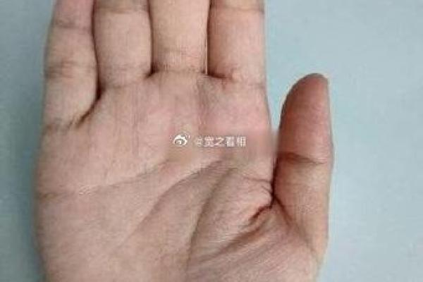解密锁链纹手相：揭示人生挑战与转折的神秘密码