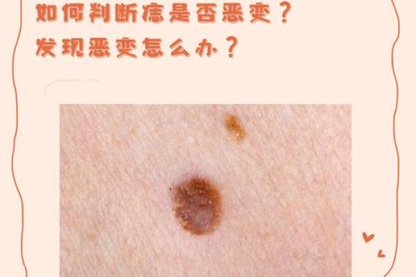 头脸痣相解析：如何通过面部痣位判断命运与个性