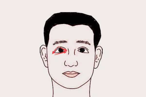 家暴男面相特征解析：从面相看隐藏的暴力倾向