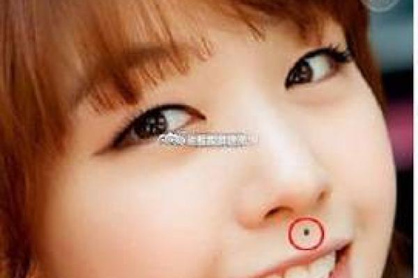 上唇痣的女人面相解读：财富与感情的深层影响