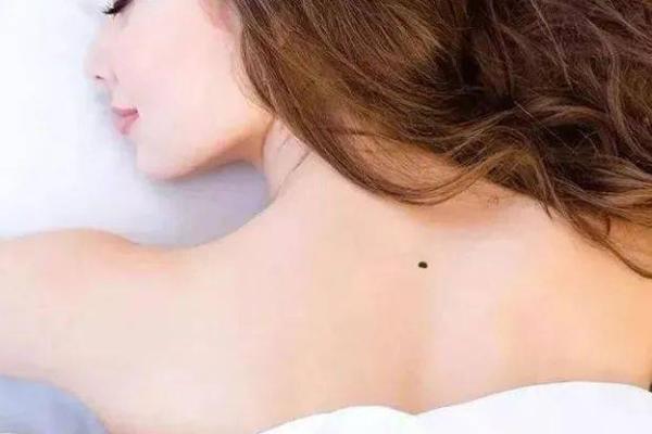 女生长痣代表什么？探索背后的深层含义