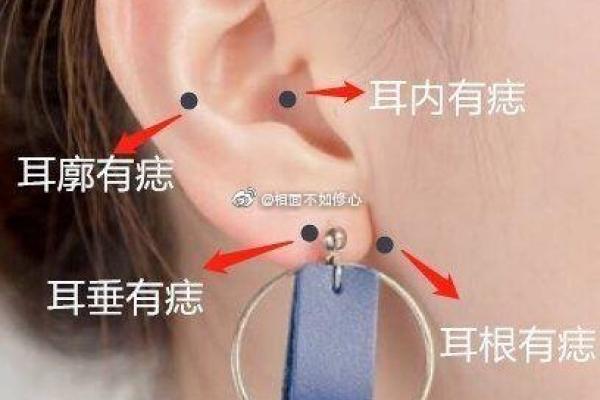女生长痣代表什么？探索背后的深层含义