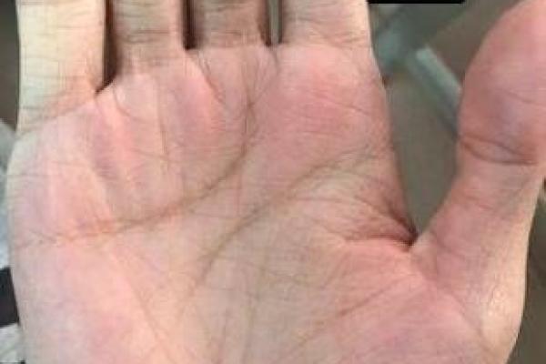 聚宝盆手相解析揭示财富运势的秘密