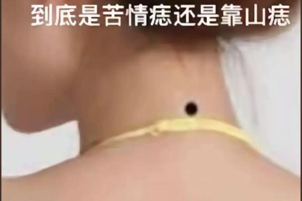 脖子上的痣代表什么？女性运势的秘密