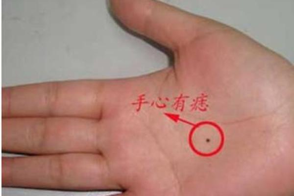 手背上的痣，暗示着你的人生走向与命运特征