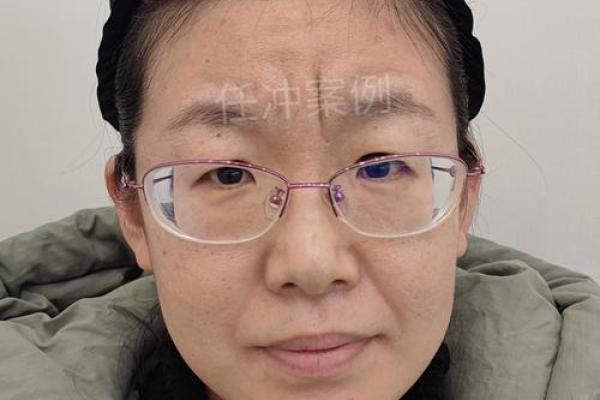 面相的改变与个人生活习惯的关系