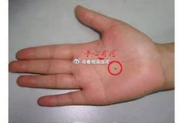 右手痣相解析：揭示掌中痣的位置与命运奥秘