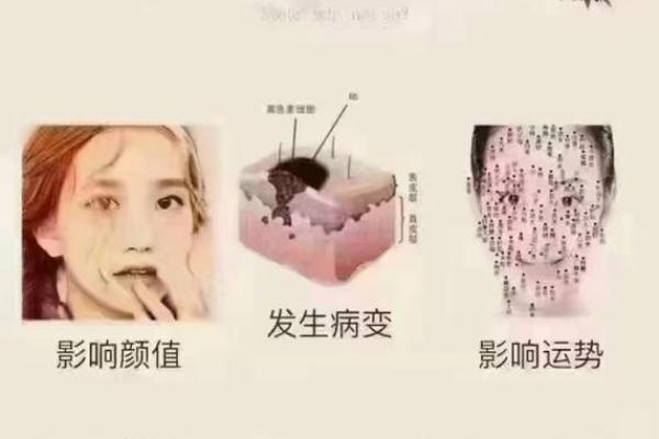 痣相与健康的关系：祛痣前你需要知道的五个注意事项