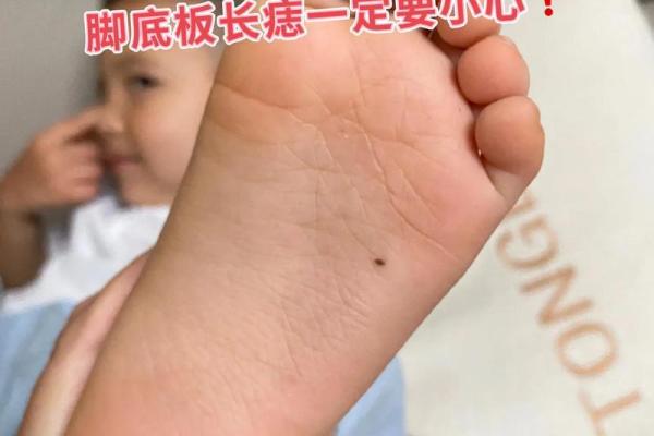脚底痣相在男性命理中的重要性