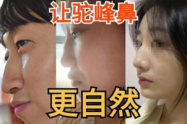 驼峰鼻面相解析：如何影响个人运势与性格特征