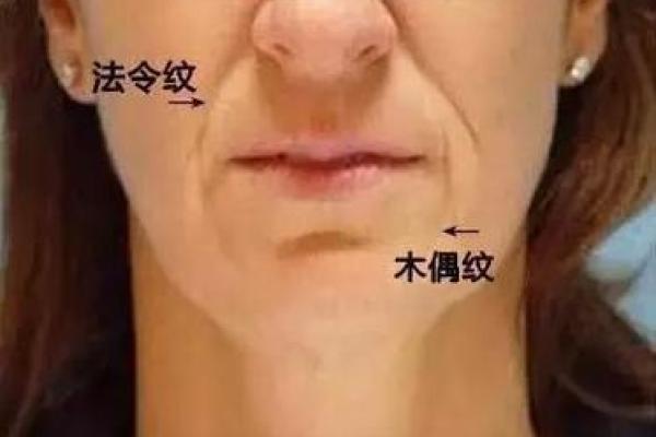 木偶纹面相的深层含义与心理解析