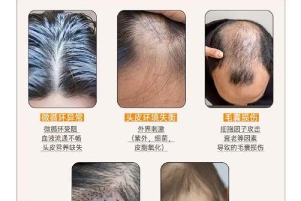 脱发面相揭秘：26岁青年的运势与命运转折