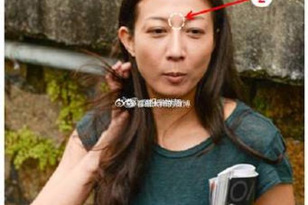 山根发青：揭秘面相中的健康预警信号