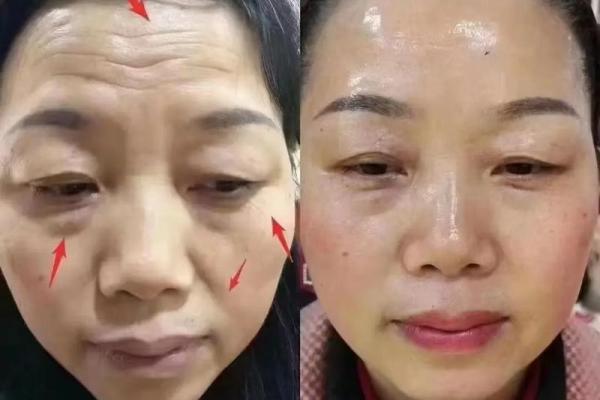 鼻尾塌面，财运如何？