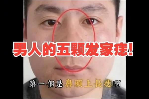 散家独门秘籍：痣相男的成功秘诀！
