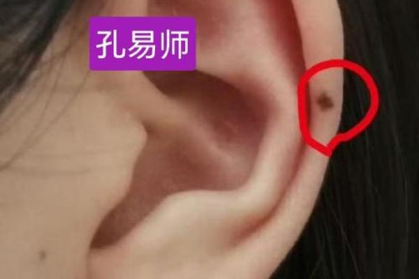 耳朵痣相解析：哪些女性更容易拥有好运？