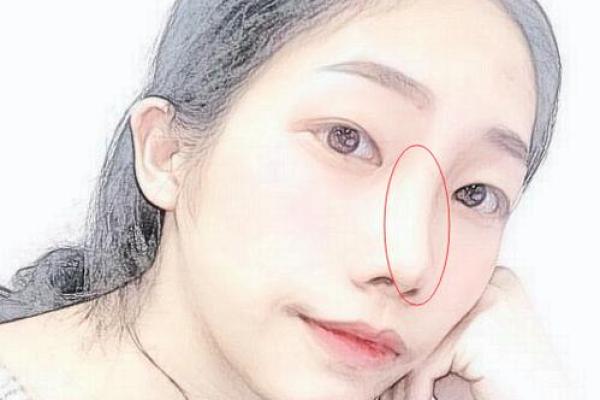 鼻子缩水，运势翻倍：揭秘面相中的神秘变化