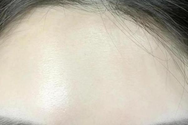 眼角纹显富贵，面相解析财运亨通之谜