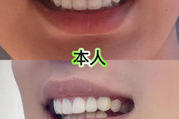 女人露牙龈面相：预示着什么样的命运？
