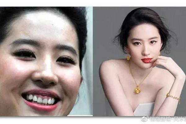 女人露牙龈面相：预示着什么样的命运？