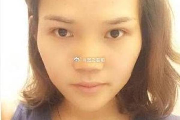 额头发黄面相揭秘：运势起伏与性格特征解析