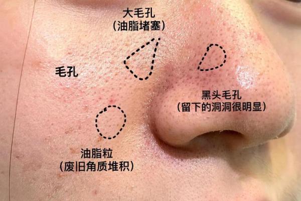 面部小秘密，鼻毛白毛透露惊人命理！