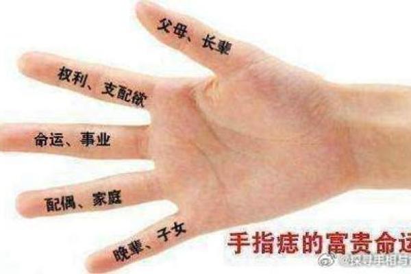 穷苦男人必看：痣相揭秘，财运逆袭的秘密！