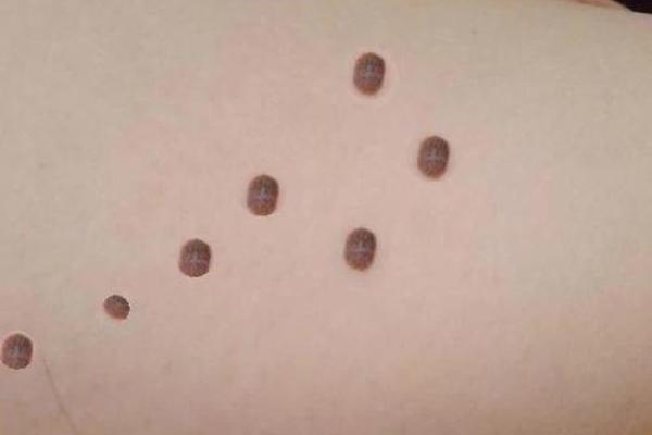 胸口红痣运势解析：你的好运从这里开始？