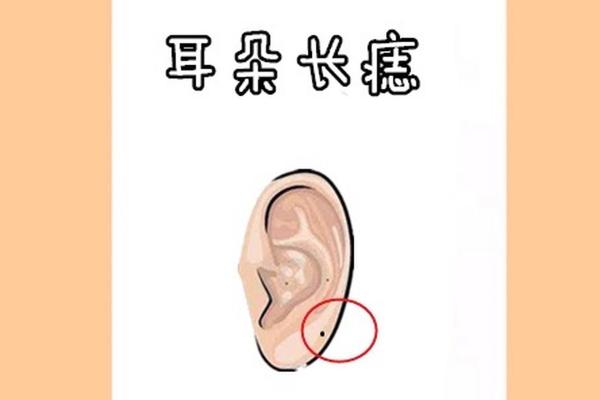 耳根有痣，命运非凡！揭秘女人痣相中的神秘力量