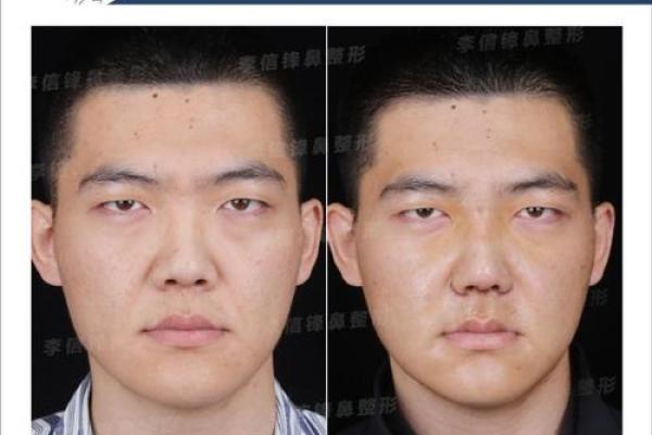 鼻头痣男：他们的生活轨迹竟然如此神奇！