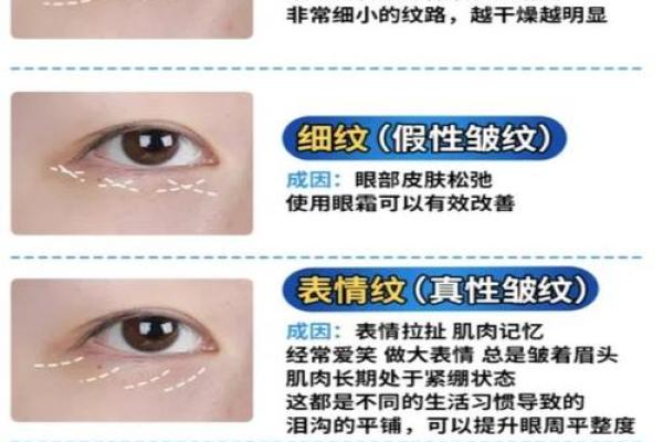 眼角纹揭秘：洞察岁月痕迹的面相奥秘