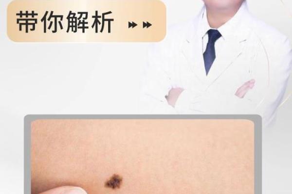 痣相解析：这些痣相预示着你的人生轨迹！