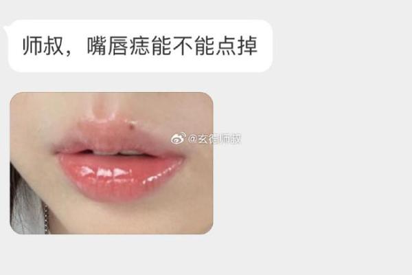 唇边痣相，揭秘运势秘密！