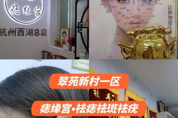 男人左胸痣，是幸运还是诅咒？揭秘痣相之谜