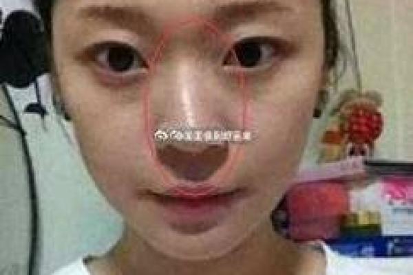 鼻头歪斜面相之谜