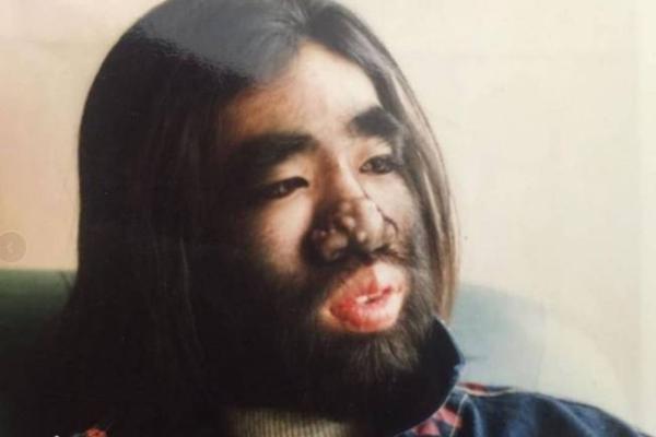 脸上长长毛，命理揭秘惊人真相！