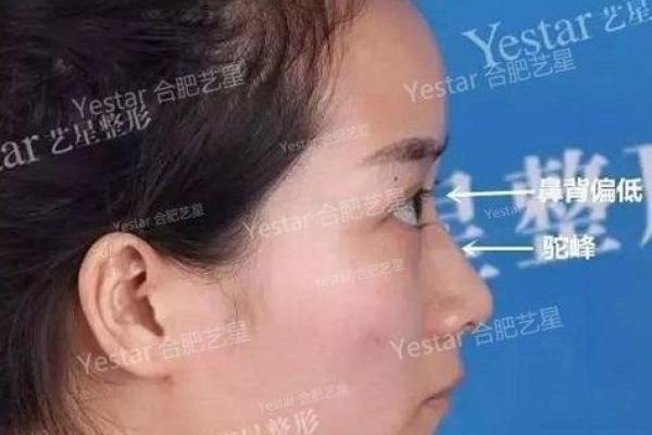 塌鼻女人面相揭秘：命运多舛还是天生丽质？