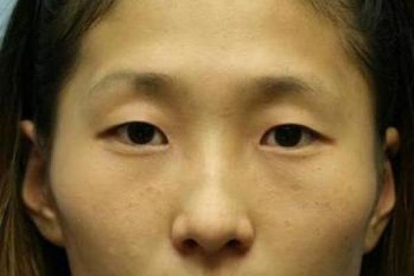 面相揭秘：人中肉厚，富贵荣华之相