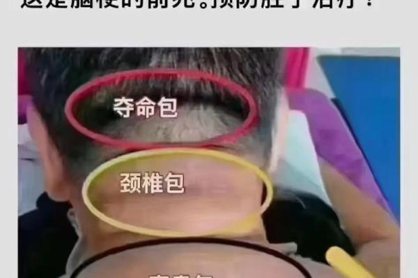 脖子后面长毛：预示着非凡命运的神秘面相！