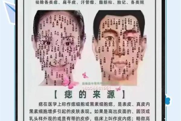 痣相奥秘：脑后有痣，竟是福气的象征？