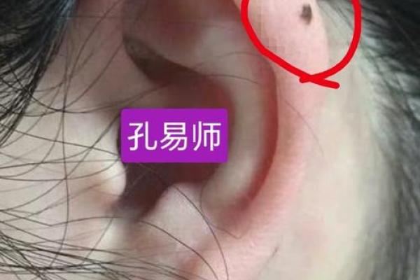 耳痣预示大运！揭秘耳长痣的五大运势解析！