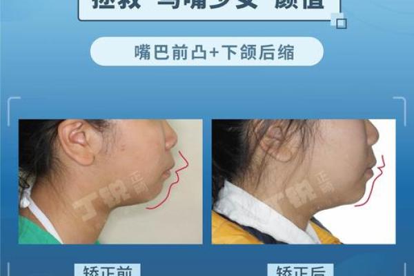 牙女面相：揭秘美貌与财运兼具的秘密