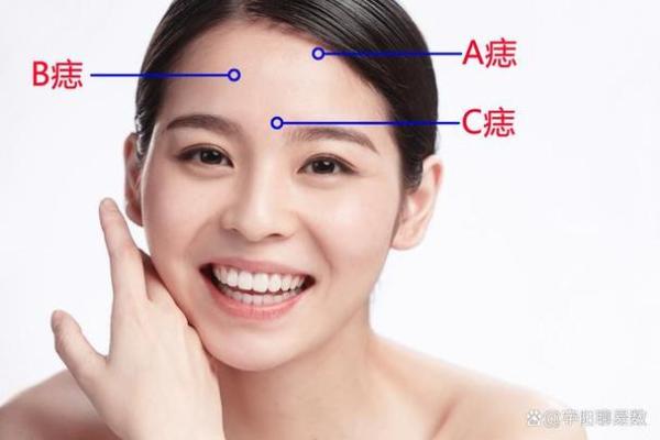 女生必备！5种正确痣相让你运势加分
