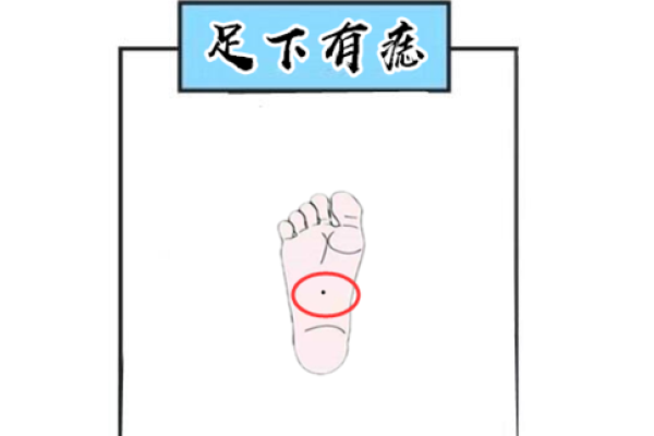 足下痣相解读：好运连连，富贵满堂！