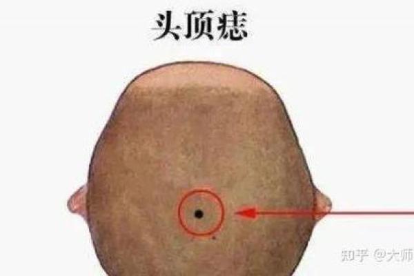 面痣如牛：男子运势大揭秘！